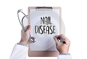 NAIL DISEASE Fungus Infection on Nails Hand, Finger with onycho photo