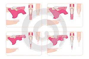Nail extension for different shapes photo