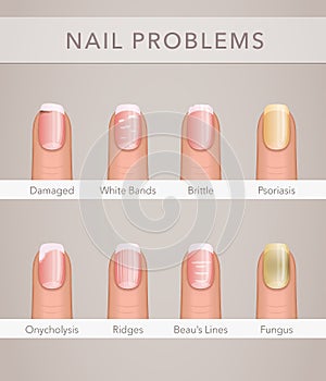 Nail problems and illness, vector poster