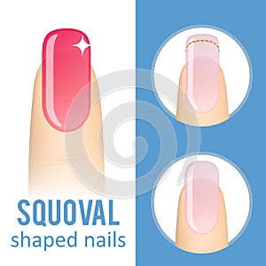 Nail shape squoval photo