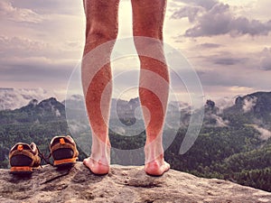 Naked male legs with horrible blister on peak. Injured rock climber heel