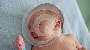 Naked Newborn Baby Red Face Portrait Acne Allergic Irritations Early Days Crying On Blue Background. Child At Start