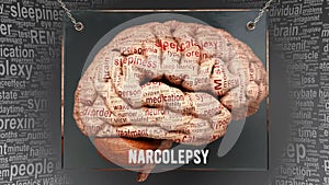 Narcolepsy in human brain