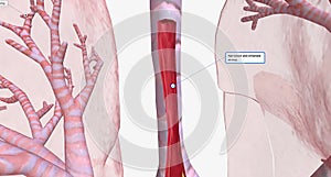 The Narrowed and inflamed airway