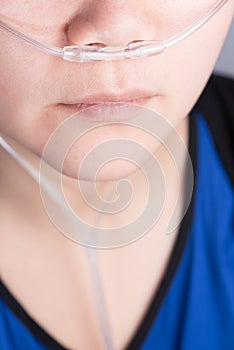 Nasal cannula for oxygen delivery on a woman patient