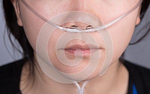 Nasal cannula for oxygen delivery on a woman patient