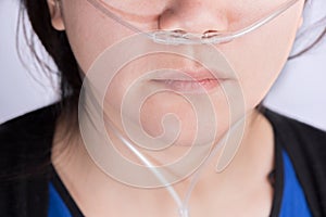 Nasal cannula for oxygen delivery on a woman patient