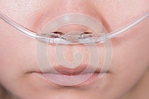 Nasal cannula for oxygen delivery on a woman patient photo