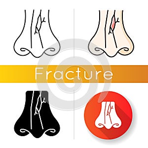 Nasal fracture icon. Broken nose bone. Crack in nose cartilage. Facial injury, trauma. Accident. Medical condition