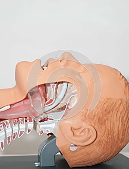 Naso-pharyngeal tube used to open the airway used to open the airway photo