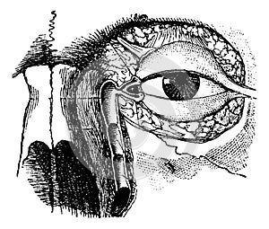 Nasolacrymal Duct, vintage engraving