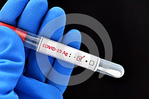 Nasopharyngeal swab negative with COVID-19 by antigen test kit