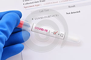 Nasopharyngeal swab not detected with COVID-19