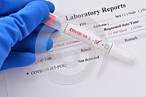 Nasopharyngeal swab not detected with COVID-19 test