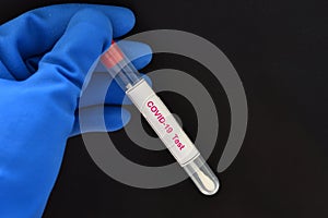 Nasopharyngeal swab from patient for COVID-19 test