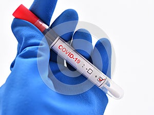 Nasopharyngeal swab positive with COVID-19 test