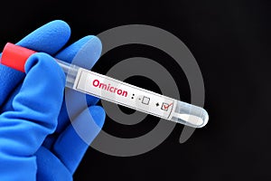 Nasopharyngeal swab positive with Omicron COVID-19