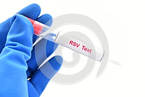Nasopharyngeal swab RSV test