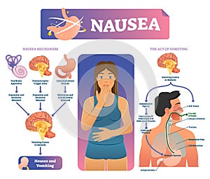 Nausea vector illustration. Labeled medical vomiting explanation scheme.