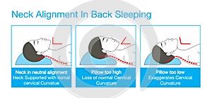 Neck alignment in back sleeping photo