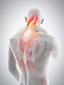 neck pain photo