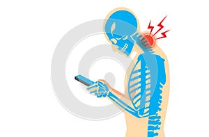 Neck Pain from Smartphone