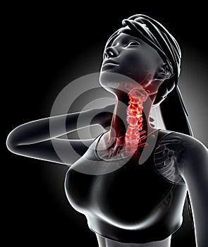 Neck painful - cervica spine skeleton x-ray, 3D illustration.