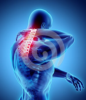 Neck painful - cervical spine skeleton x-ray, 3D illustration.