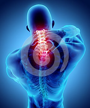 Neck painful - cervical spine skeleton x-ray, 3D illustration.