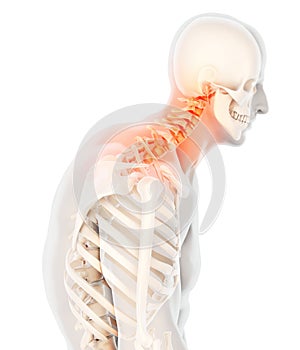 Neck painful - cervical spine skeleton x-ray, 3D illustration.