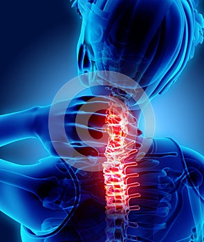 Neck painful - cervical spine skeleton x-ray, 3D illustration.
