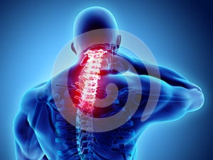 Neck painful - cervical spine skeleton x-ray, 3D illustration.