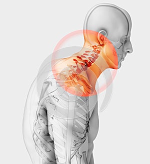 Neck painful - cervical spine skeleton x-ray, 3D illustration.