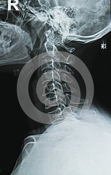 neck x-ray image