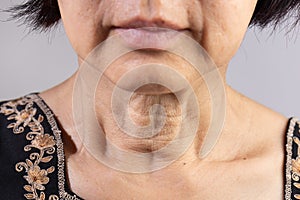 Neck wrinkles and lines of senior woman. Facial and Neck Skin Aging Change on senior woman.