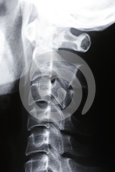 Neck X-Ray