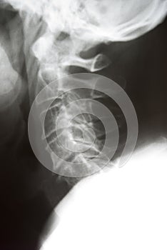 Neck xray