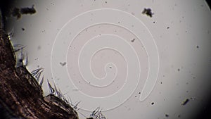 Needle body of a bloodworm Chironomidae moves in dirty water close-up in microscope