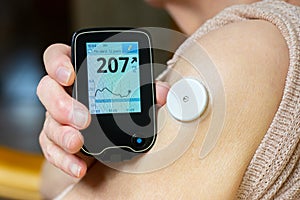 Needle-free blood glucose meter