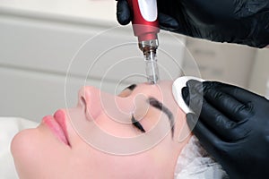 Needle mesotherapy. Cosmetologist performs needle mesotherapy on a womans face