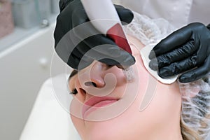 Needle mesotherapy. Cosmetologist performs needle mesotherapy on a womans face photo