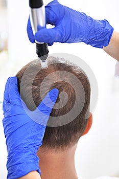 Needle mesotherapy of the scalp.