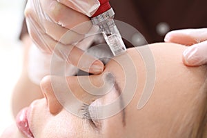 Needle mesotherapy treatment aesthetic photo