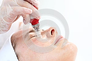 Needle mesotherapy treatment aesthetic execution in the beauty salon