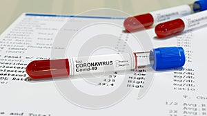 Negative or positive test result by using rapid test device for COVID-19, novel coronavirus 2019. 3d rendering