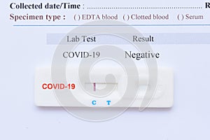 Negative test result of COVID-19 virus