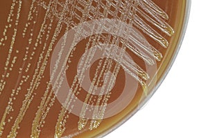 Neisseria bacterial colonies on chocolate agar plate photo