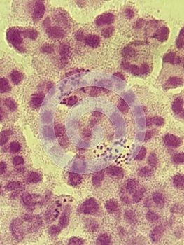 Neisseria gonorrhea - intracellular Gram negative diplococci
