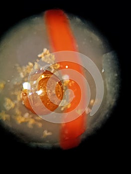 Nematode cysts that have begun to rupture are visible under the microscope