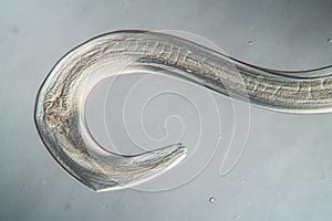 Nematode Parasitic worm